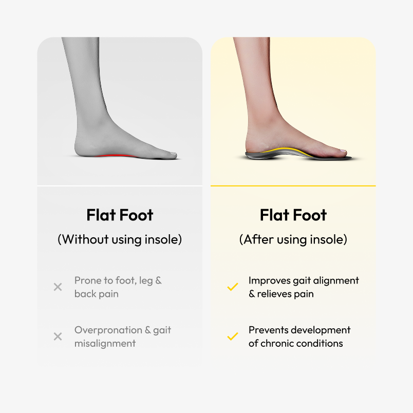 Foot Arc Support