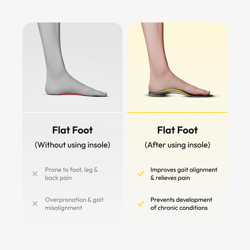 Foot Arc Support