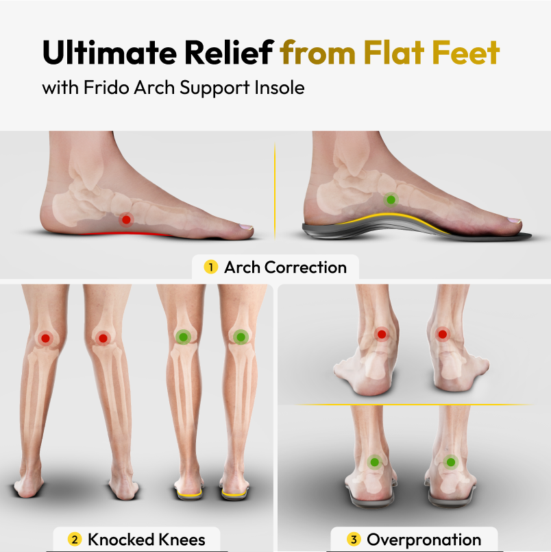 Foot Arc Support
