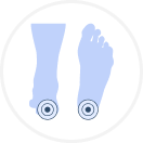 Orthopedic Heel Pad