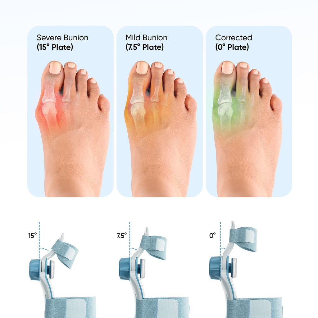 Bunion Corrector